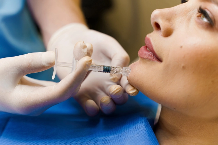 Restylane fillers