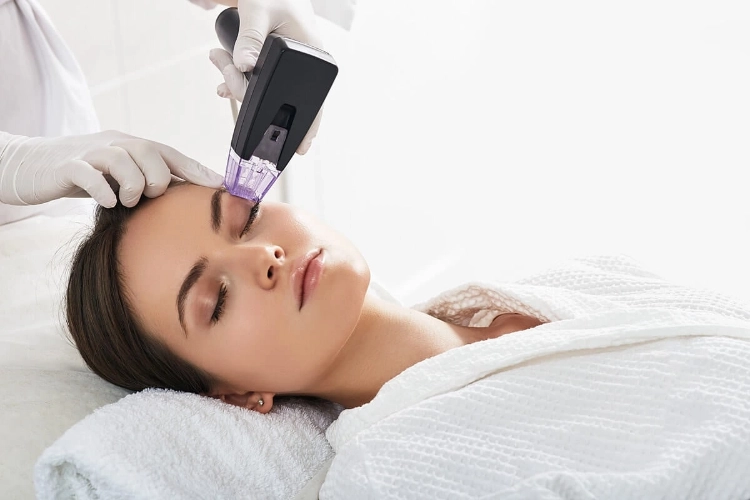 Microneedling with RF Morpheus8
