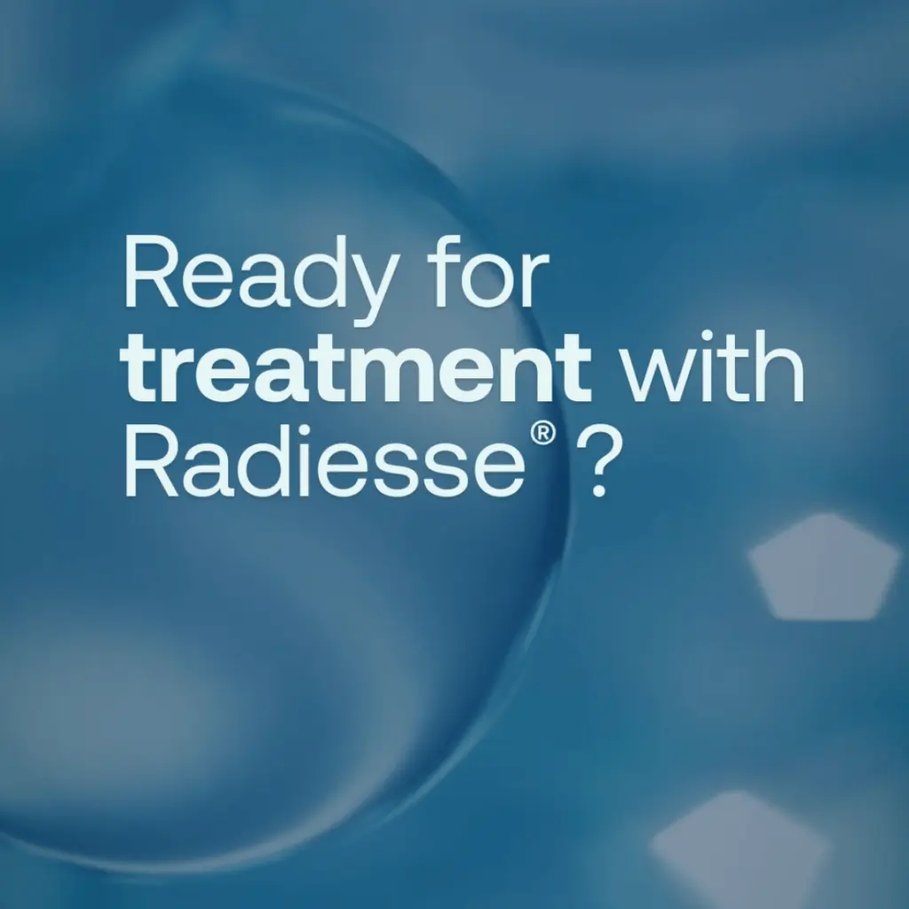 Ready for treatment with radiesse featured