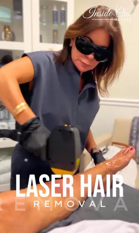 LAser hair removal