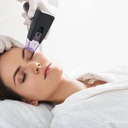 Microneedling with RF Morpheus8